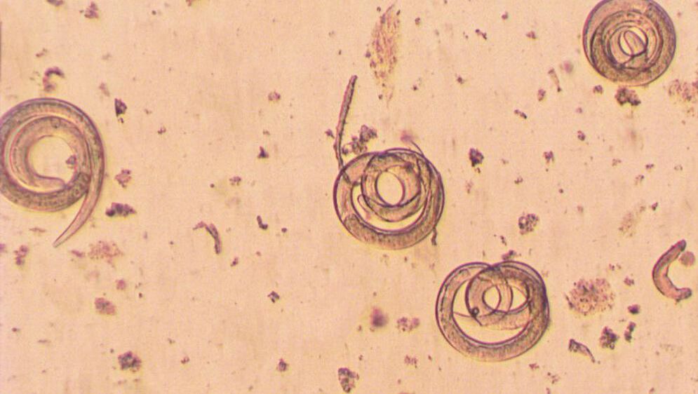 Pinworms - népi jogorvoslatokkal való kezelés Pinworms kezelés nélkül - Pinworms méretük